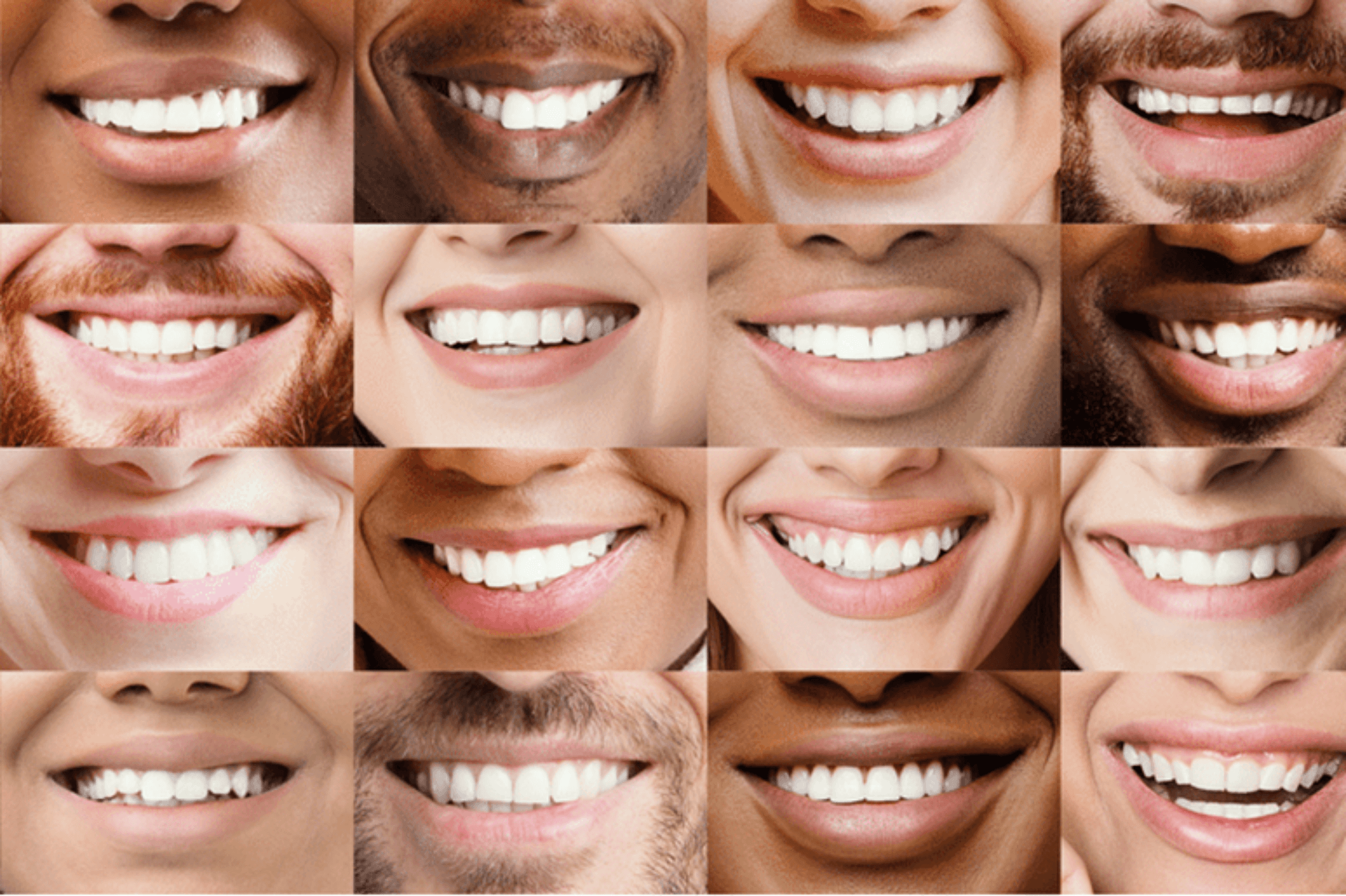 Smile transformations grid