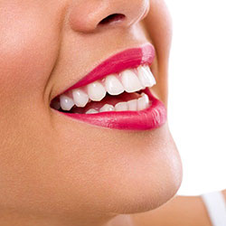 SNAP-ON SMILE